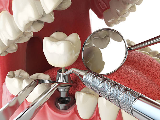 Best Knocked-Out Tooth Emergency  in Prague, OK
